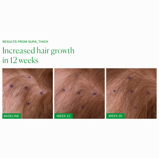 SUPA_THICK SCALP SERUM