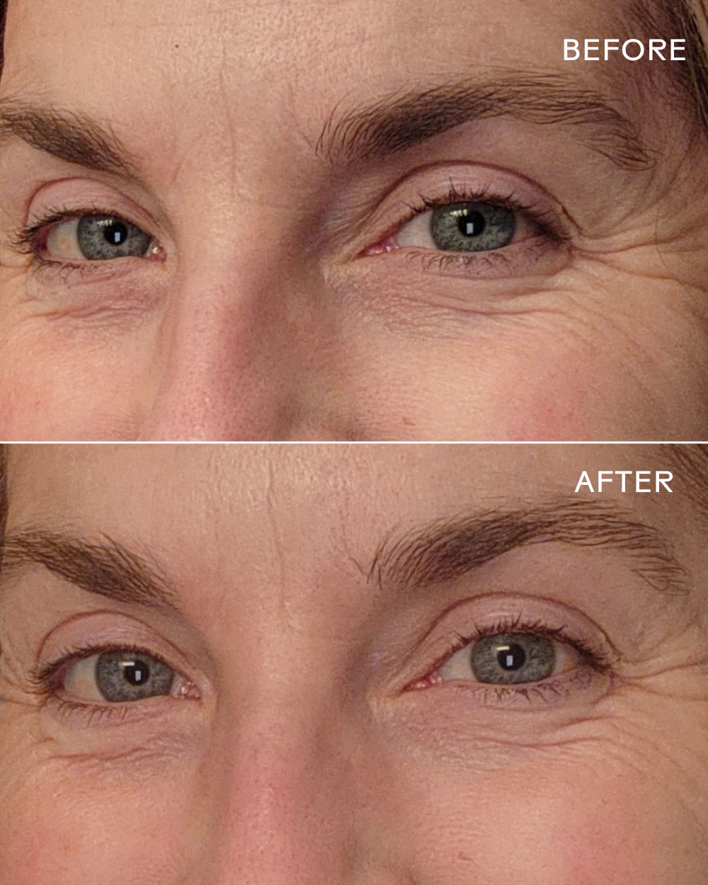 EyeHero™ Bio-Retinol Smoothing Eye Cream