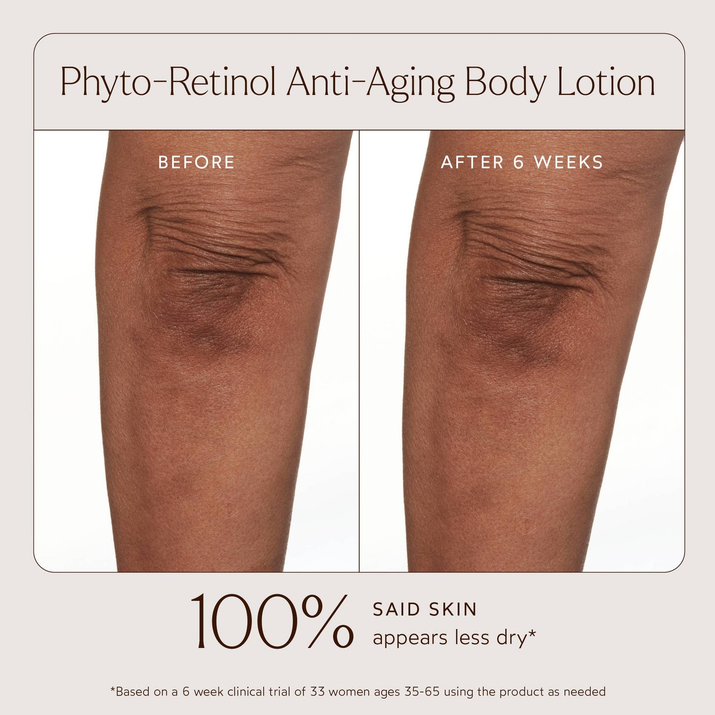 Phyto-Retinol Anti-Aging Body Lotion