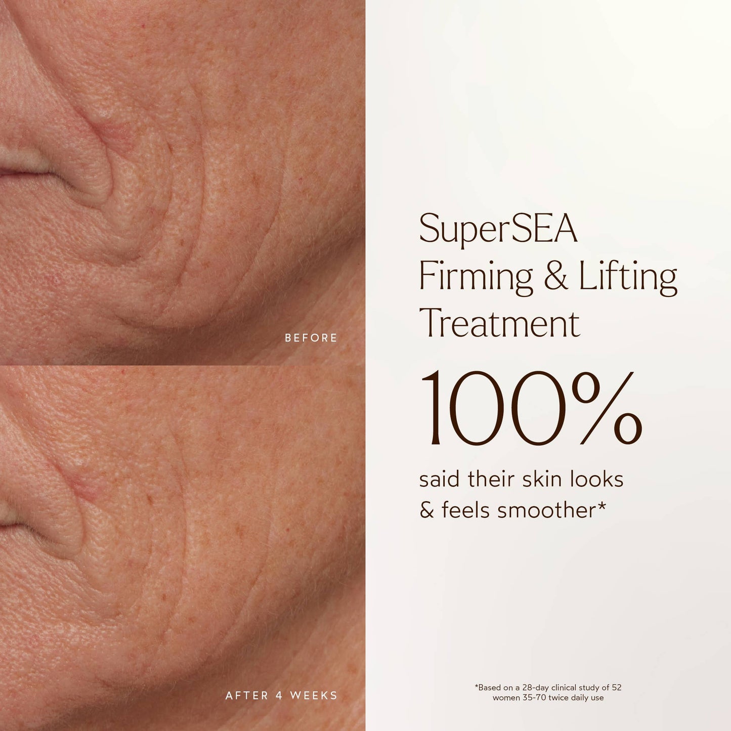 SuperSEA Firming & Lifting Treatment