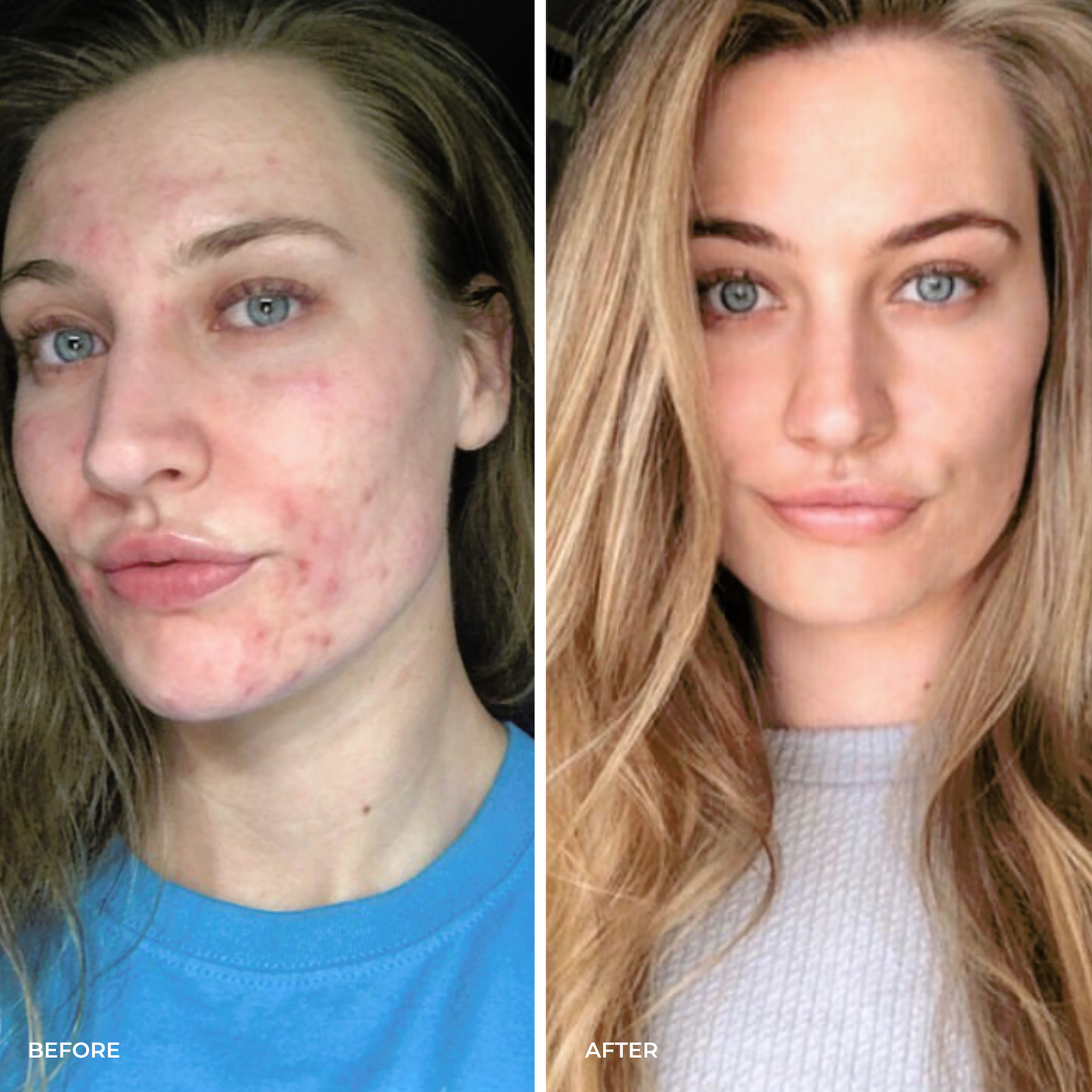 Youth Beauty Face Oil