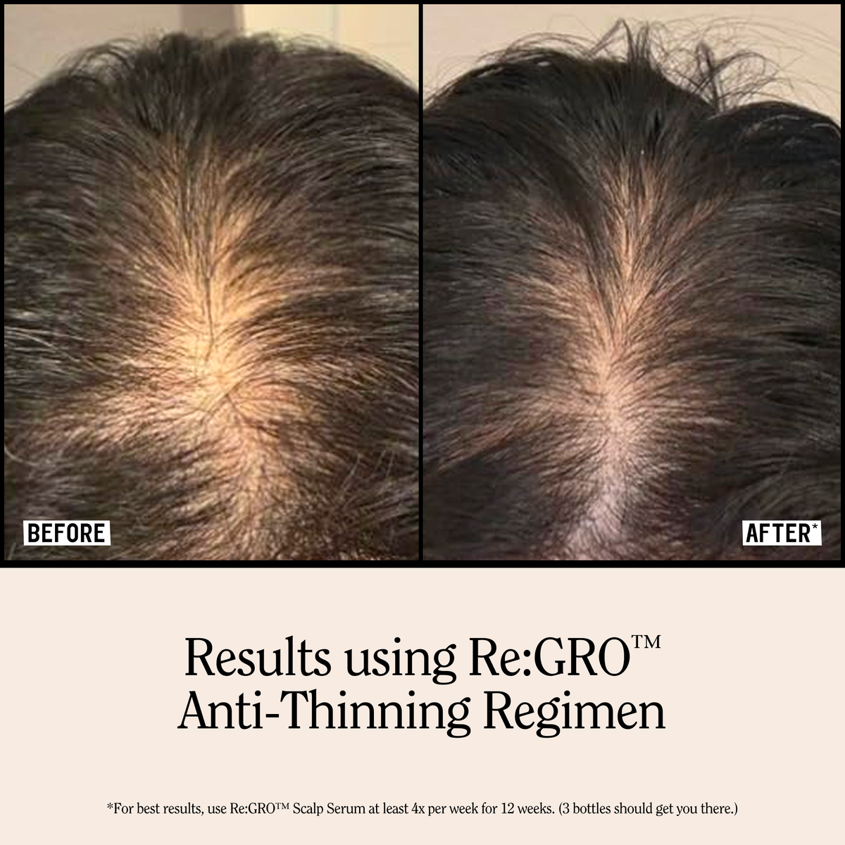 Re:GRO Anti-Thinning Conditioner 16.5oz