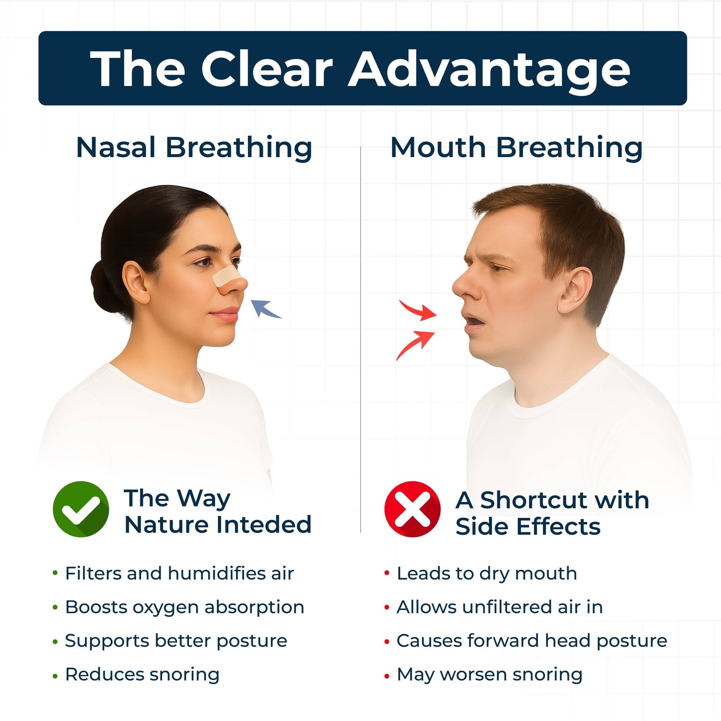 TG Nasal Strips