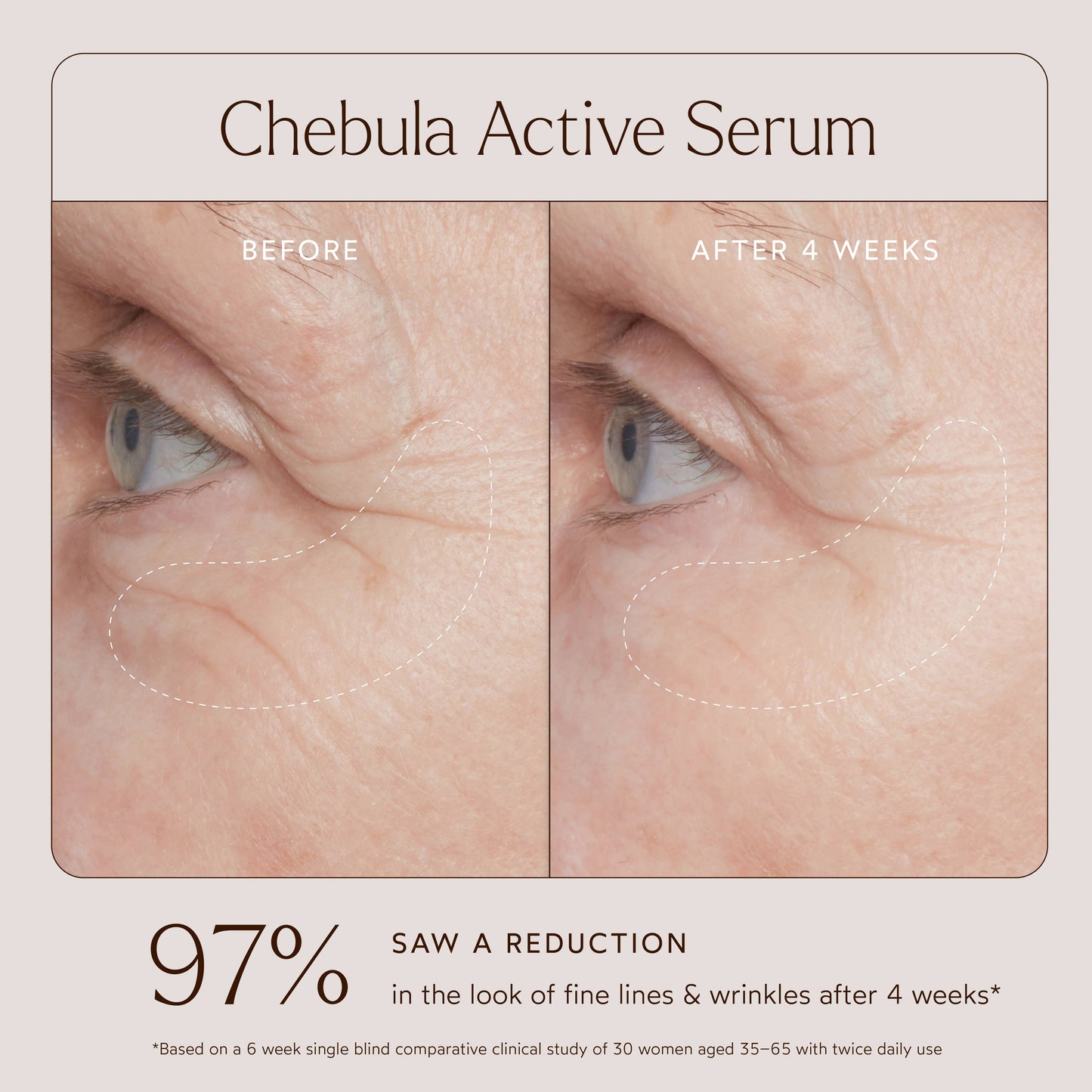 Anti-Aging Chebula Active Serum