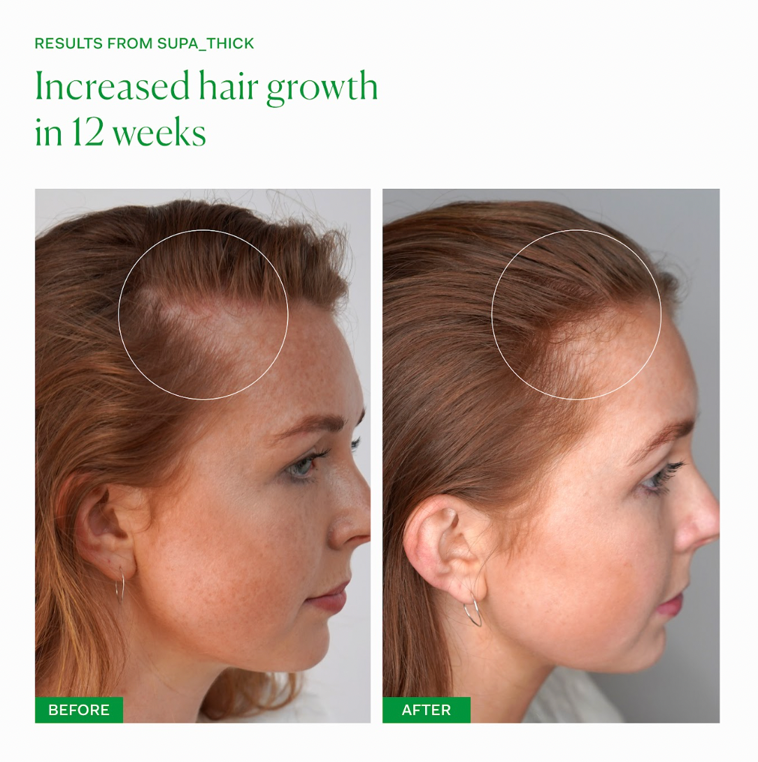 SUPA_THICK SCALP SERUM
