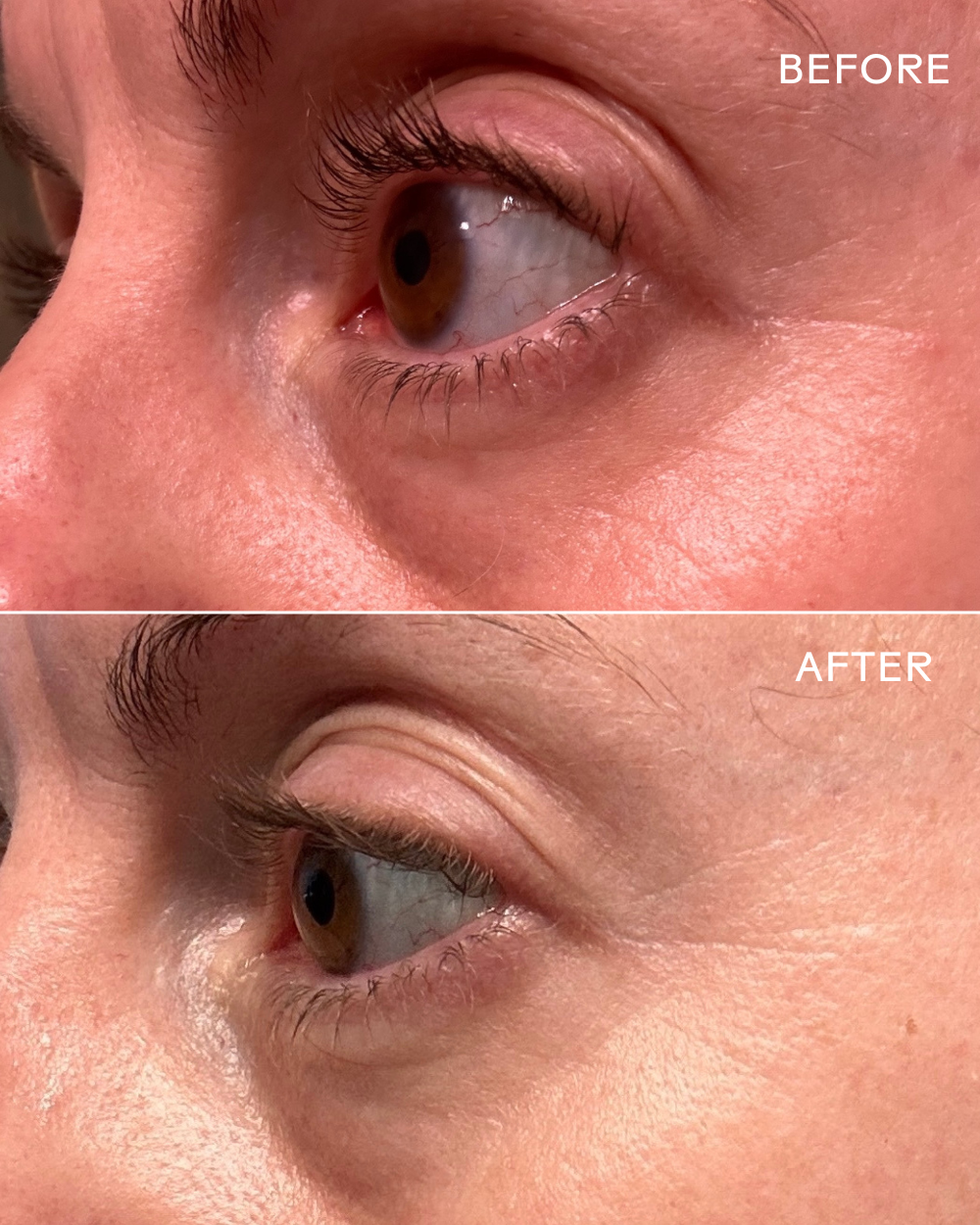 EyeHero™ Bio-Retinol Smoothing Eye Cream