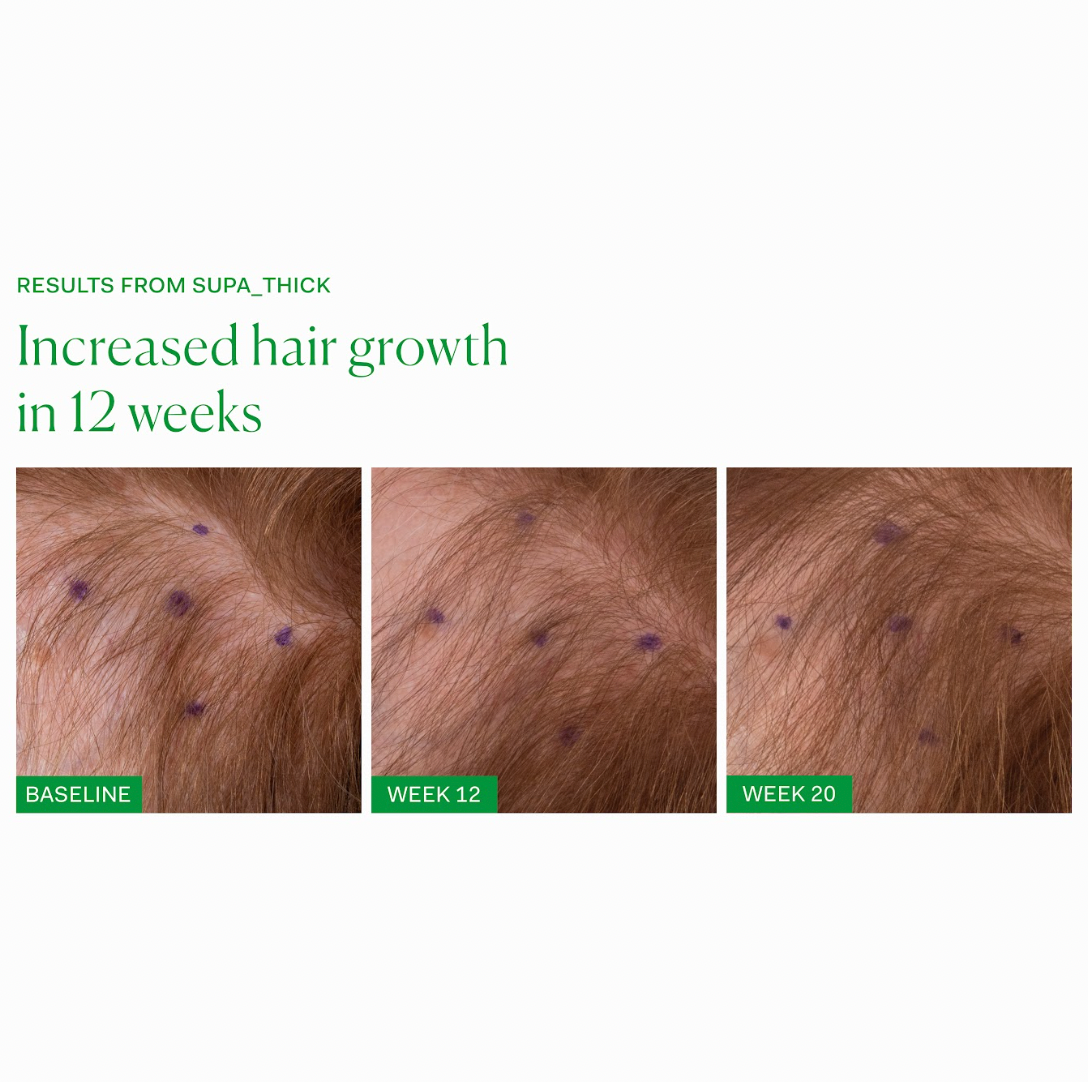 SUPA_THICK SCALP SERUM