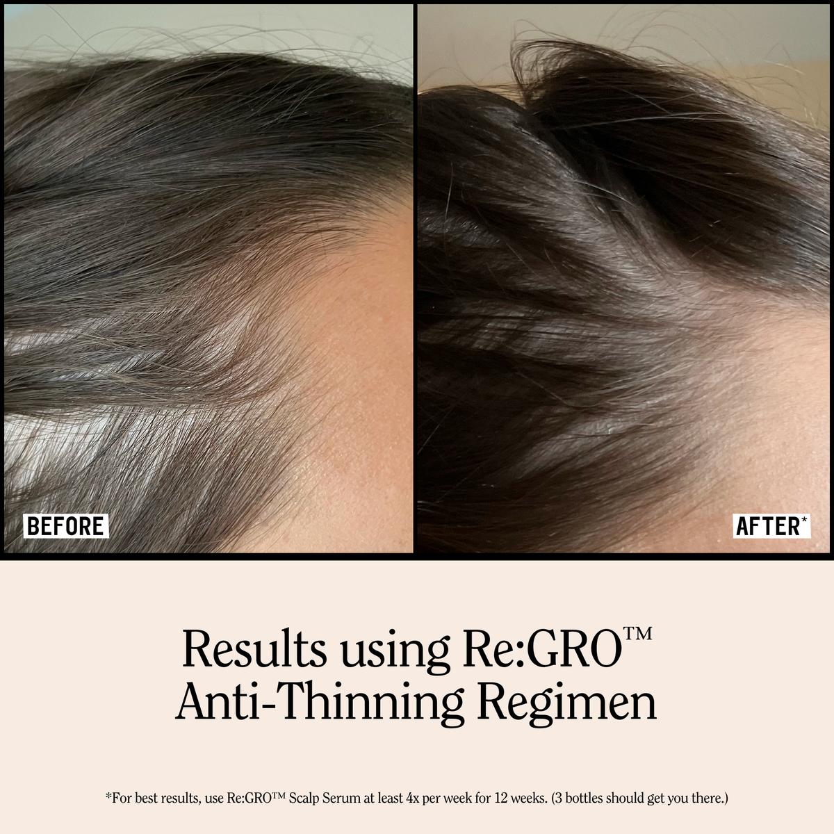 Re:Gro Anti-Thinning Shampoo 16.5oz