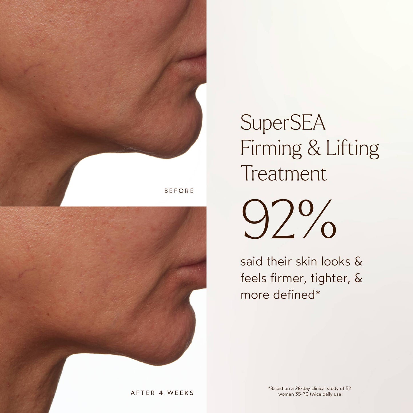 SuperSEA Firming & Lifting Treatment